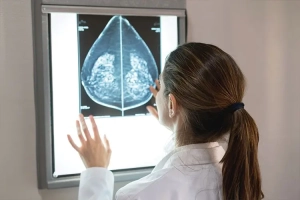 Mamografi Nedir?